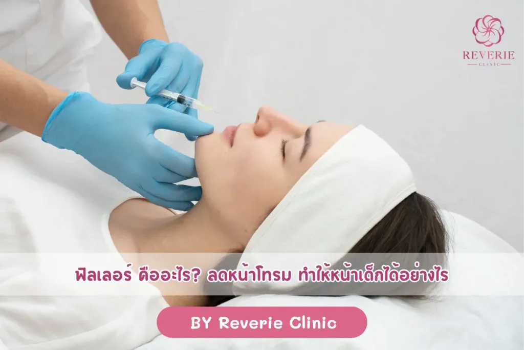 ฟิลเลอร์ คืออะไร