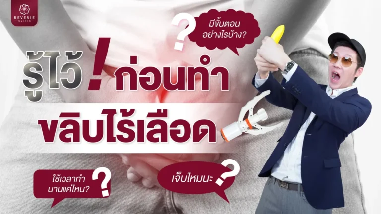 รู้ไว้ก่อนทำ ขลิบไร้เลือด