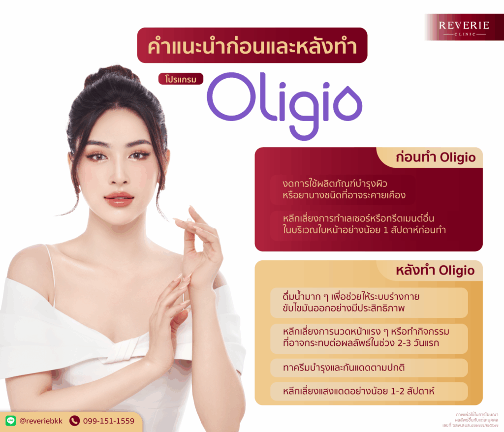 คำแนะนำก่อนและหลังทำ Oligio เช่น หลีกเลี่ยงการทำเลเซอร์ก่อนทำ ดื่มน้ำมาก และหลีกเลี่ยงแดดแรงหลังทำ 1-2 สัปดาห์