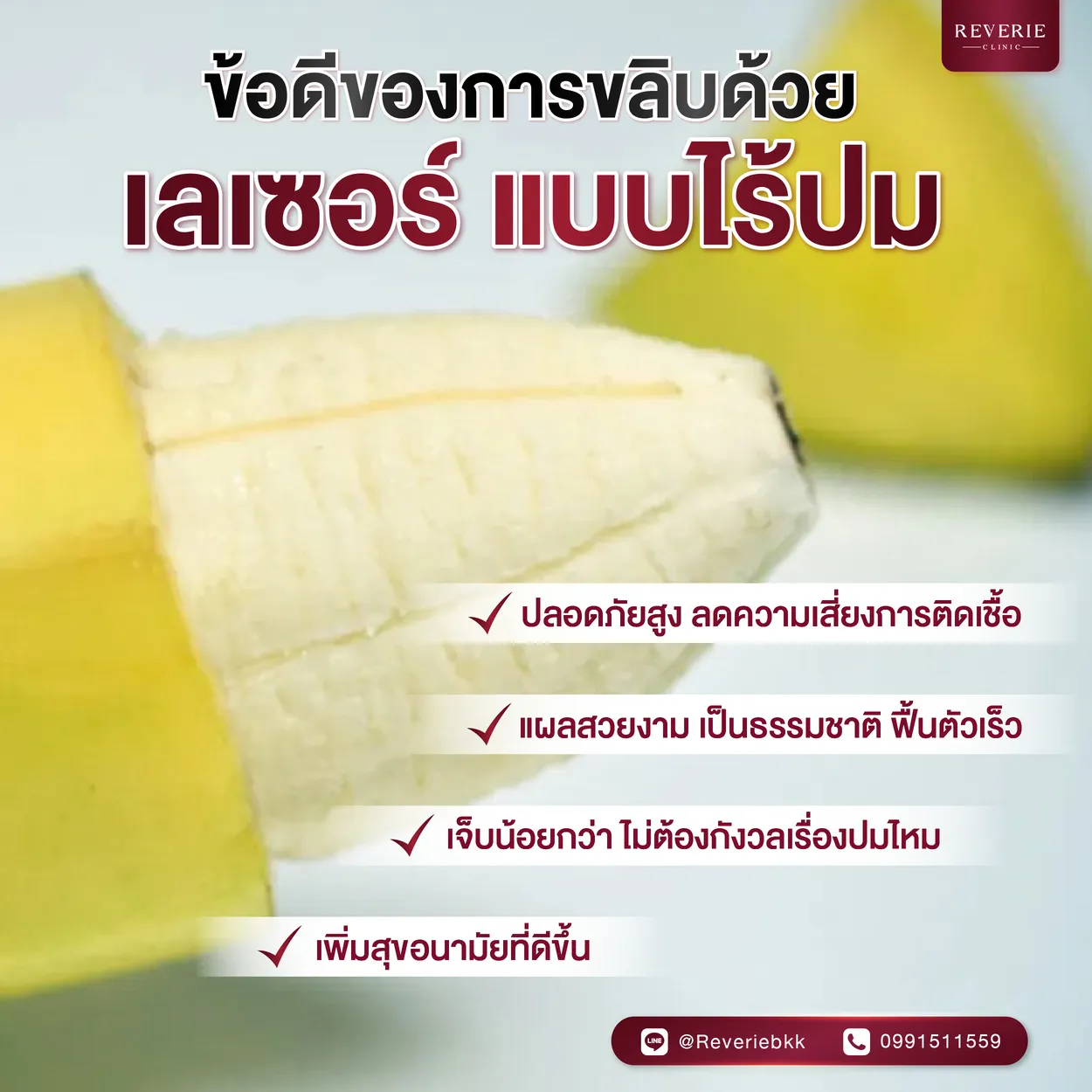 ข้อดีของการขลิบด้วยเลเซอร์ แบบไร้ปม