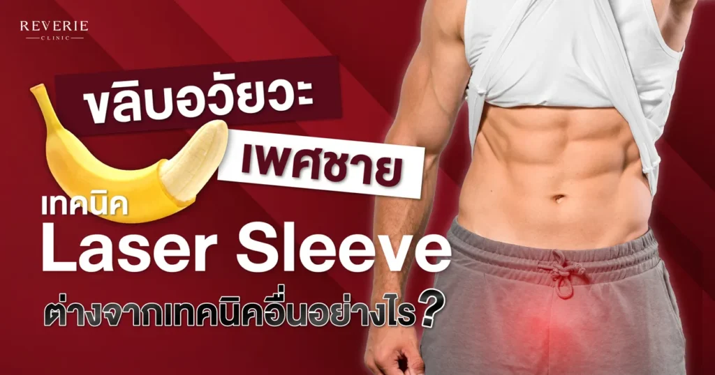 ขลิบอวัยวะเพศชายเทคนิค Laser Sleeve ต่างจากเทคนิคอื่นอย่างไร?