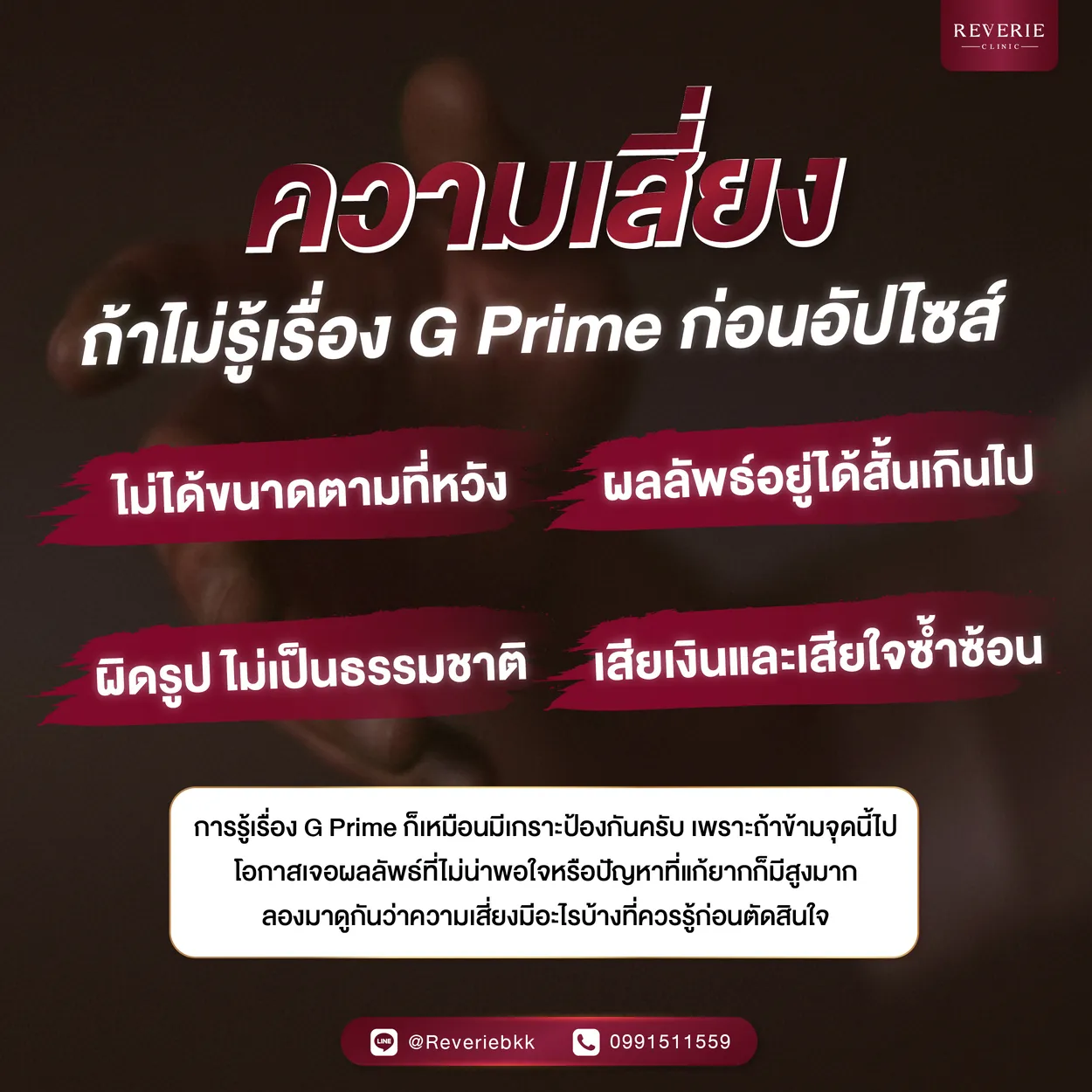 ความเสี่ยงถ้าไม่รู้เรื่อง G Prime ก่อนอัปไซส์