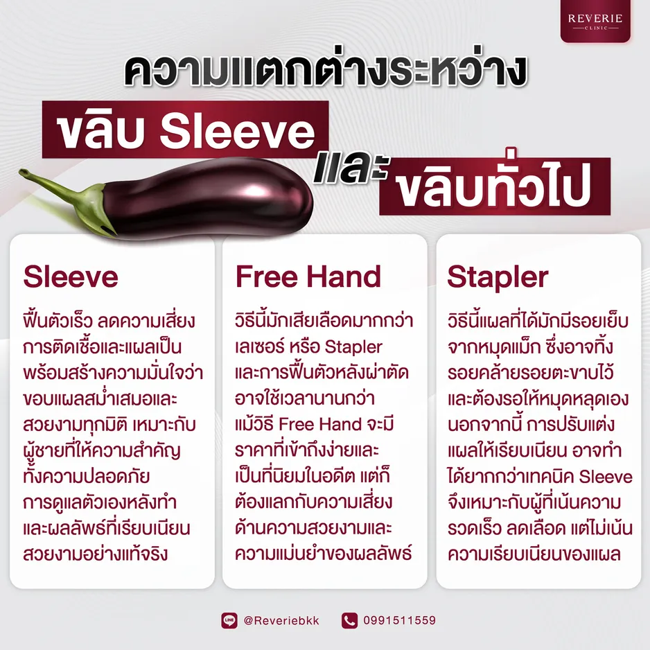 ความแตกต่างระหว่าง ขลิบ Sleeve และ ขลิบทั่วไป