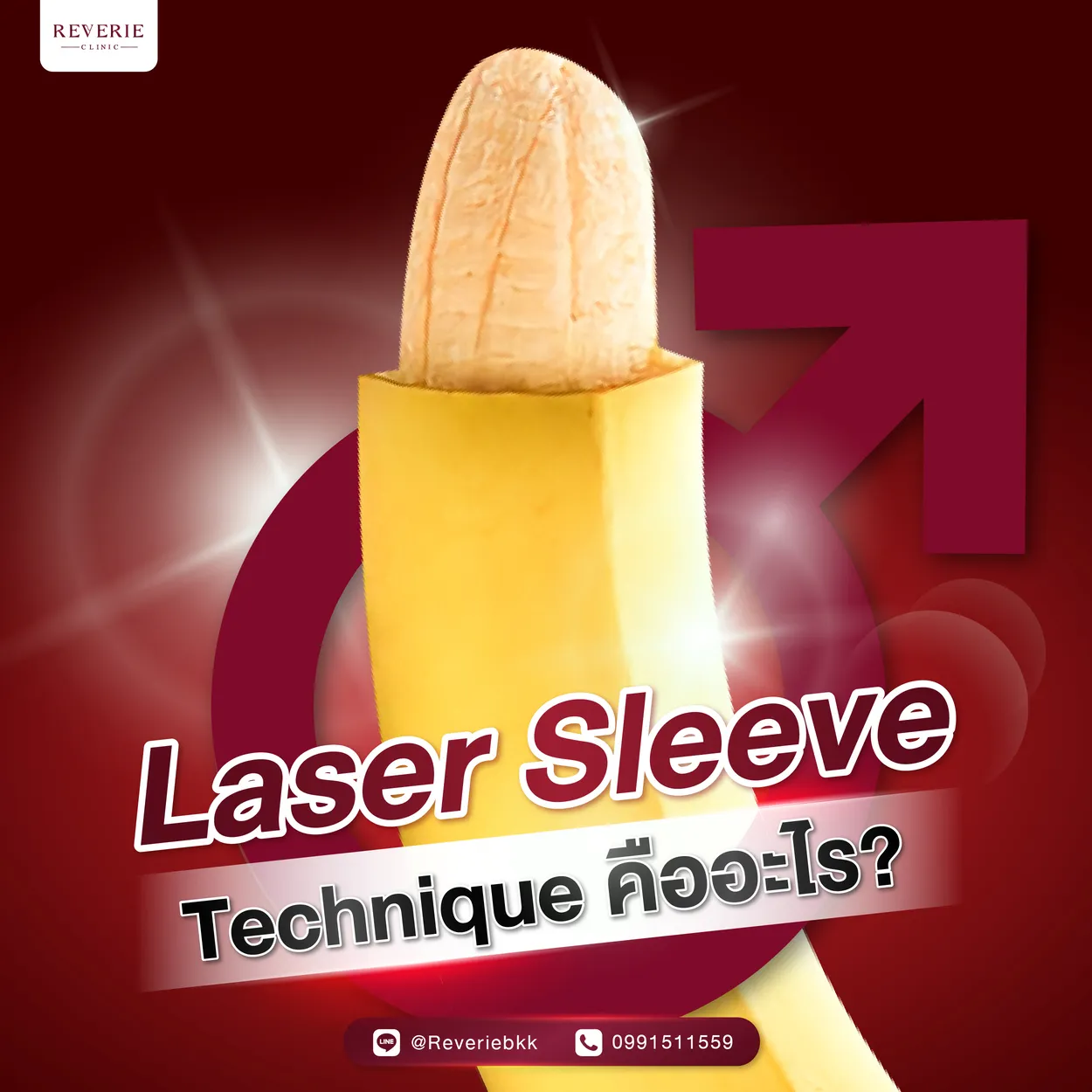 Laser Sleeve Technique คืออะไร?