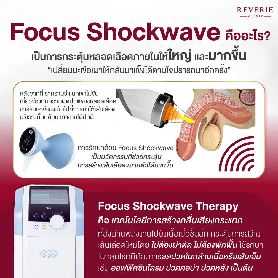 Focus Shockwave คืออะไร
