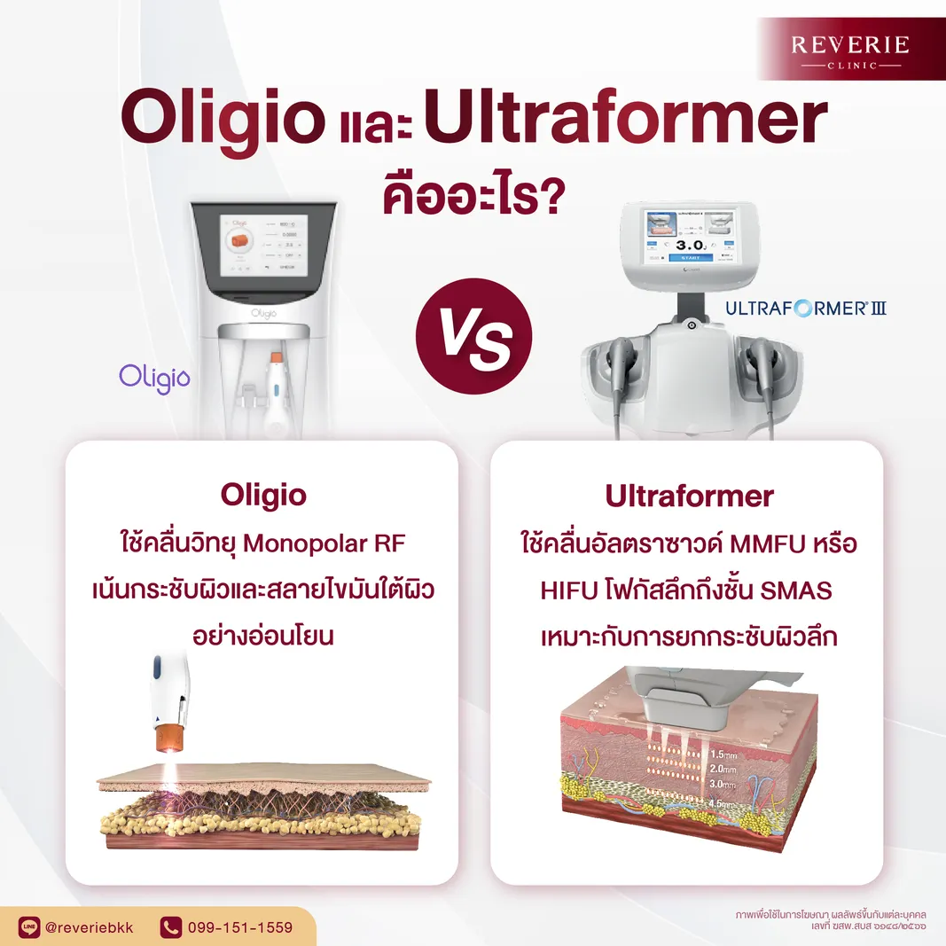 Oligio และ Ultraformer คืออะไร?