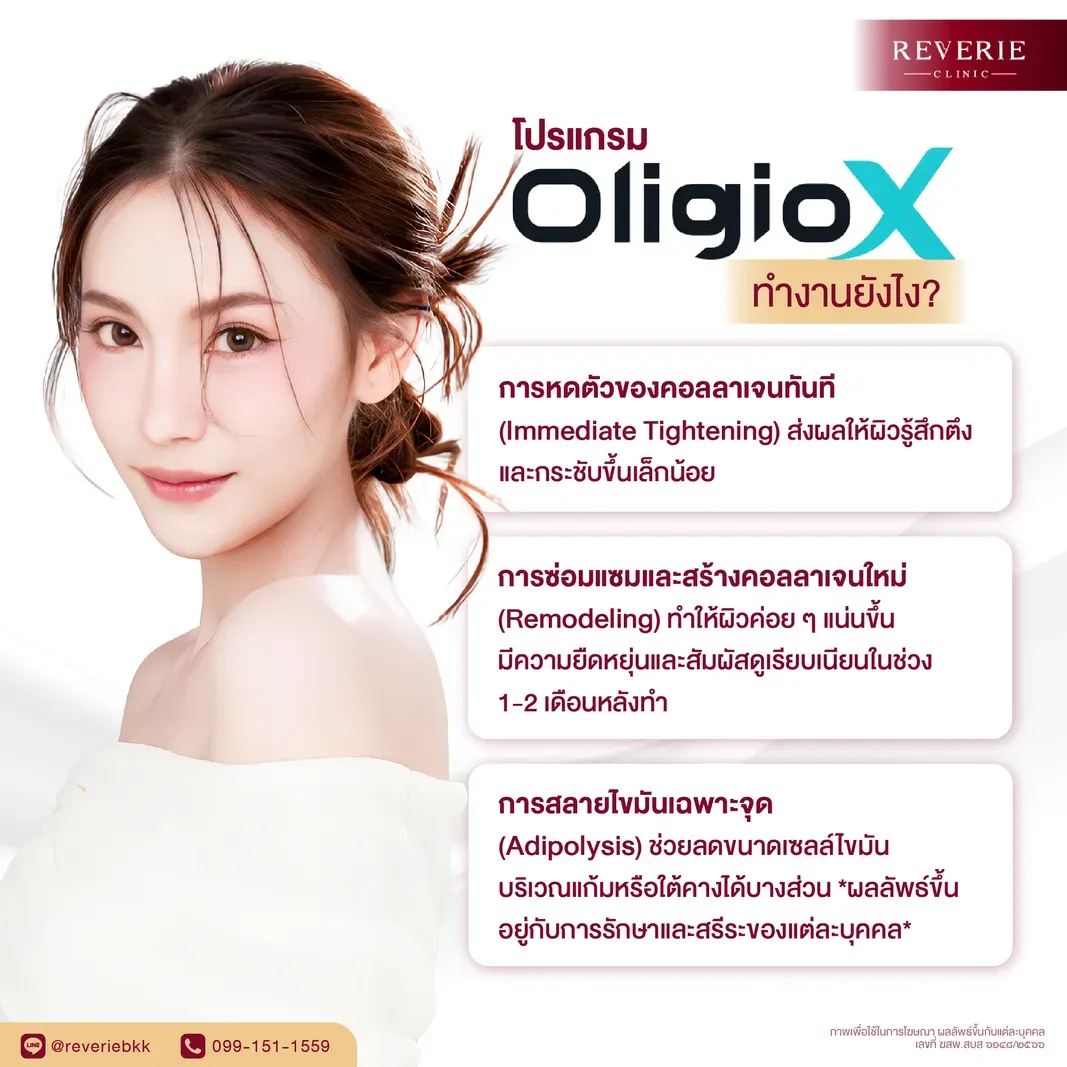 โปรแกรม OligioX ทำงานยังไง?