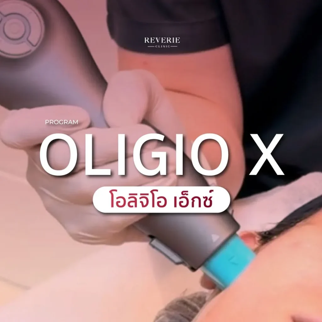 โอลิจิโอ เอ็กซ์