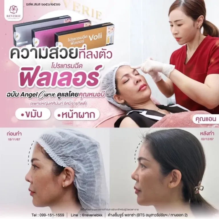 โปรแกรม Angel Curve