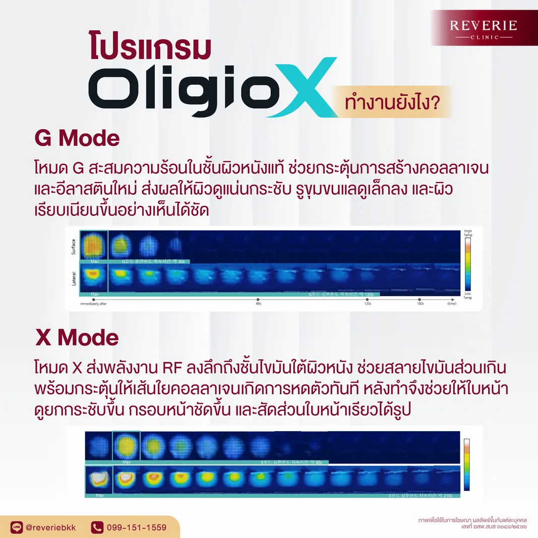 โปรแกรม OligioX ทำงานอย่างไร