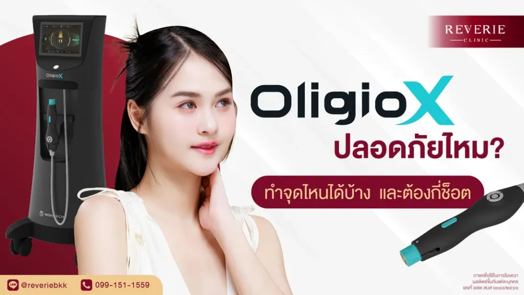 ทำ OligioX ปลอดภัยไหม จุดที่ทำได้ และจำนวนช็อตที่ควรรู้