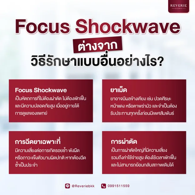 Focus Shockwave ต่างจากวิธีรักษาแบบอื่นอย่างไร?