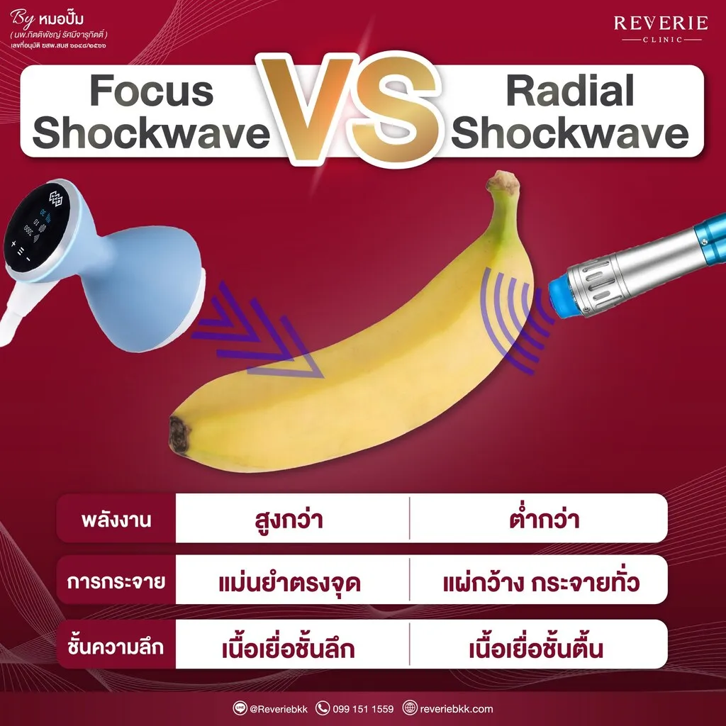Focus Shockwave VS Radial Shockwave