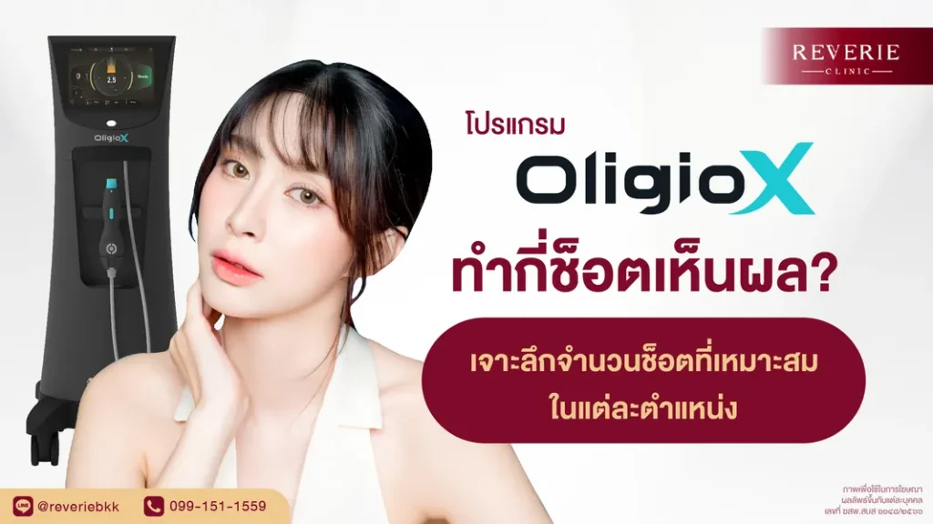 OligioX ทำกี่ช็อต เจาะลึกจำนวนช็อตที่เหมาะแต่ละตำแหน่ง เห็นผลจริง