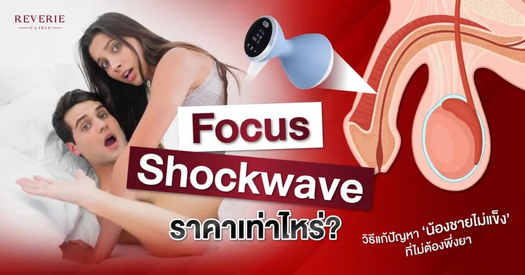 Focus Shockwave ราคาเท่าไหร่ แก้น้องชายไม่แข็ง ไม่ต้องพึ่งยา