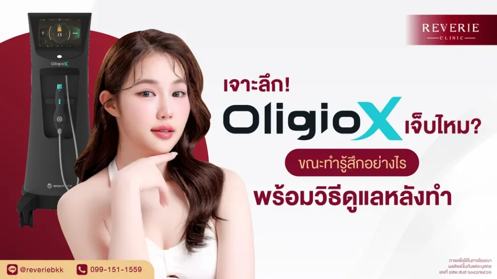 OligioX เจ็บไหม ขณะทำรู้สึกอย่างไร พร้อมวิธีดูแลหลังทำให้เห็นผลดี