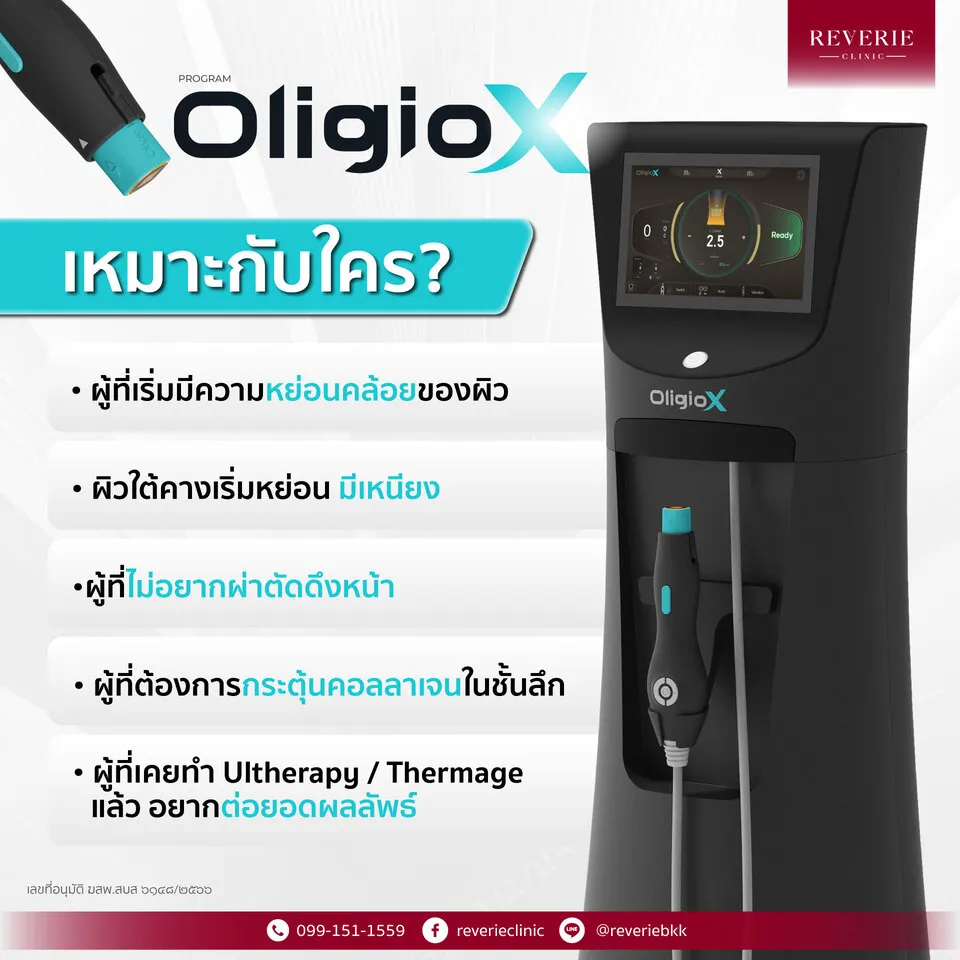 OligioX เหมาะกับใครบ้าง?