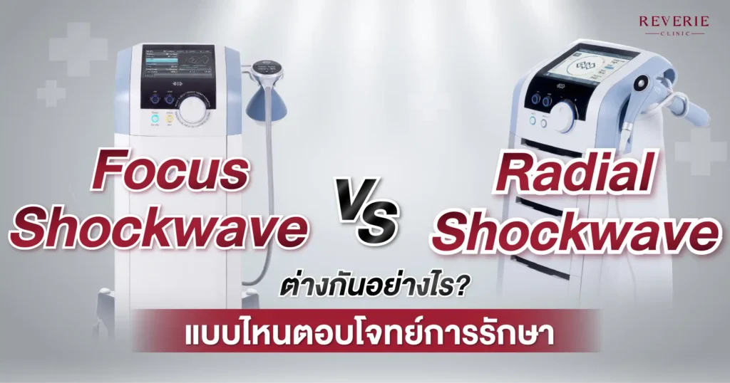 เจาะลึก Focus Shockwave VS Radial Shockwave ต่างกันอย่างไร