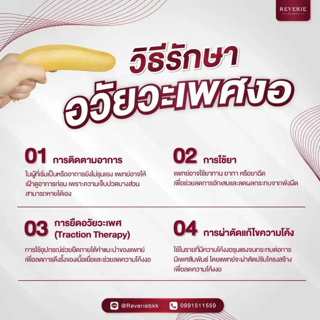วิธีรักษาอวัยวะเพศโค้งงอในปัจจุบัน