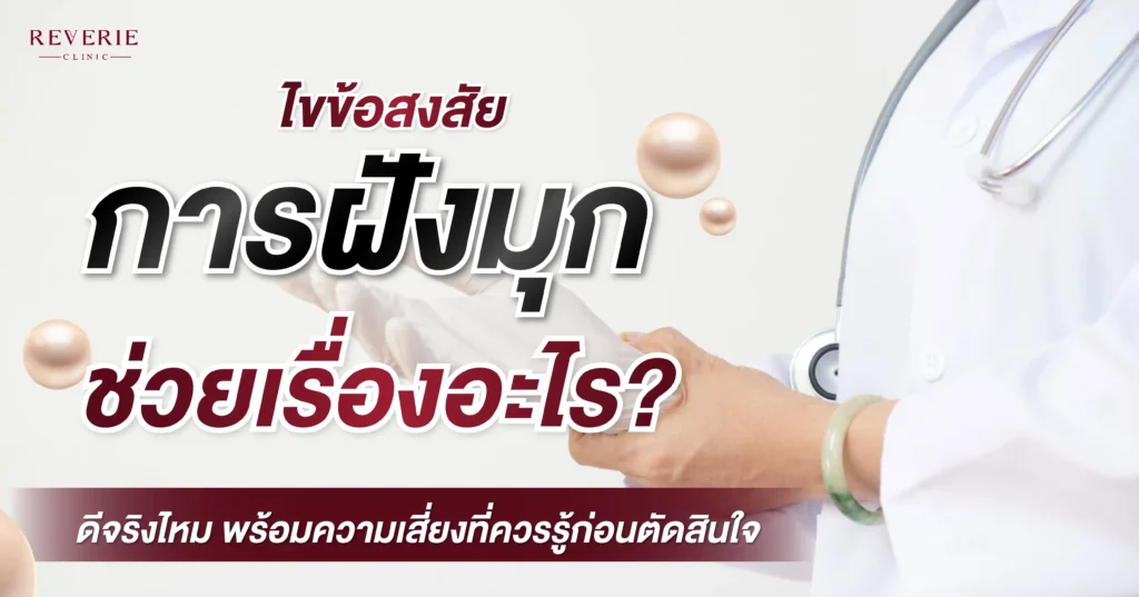 ไขข้อสงสัย ฝังมุกช่วยอะไร? ดีจริงไหม พร้อมความเสี่ยงที่ควรรู้ก่อนตัดสินใจ