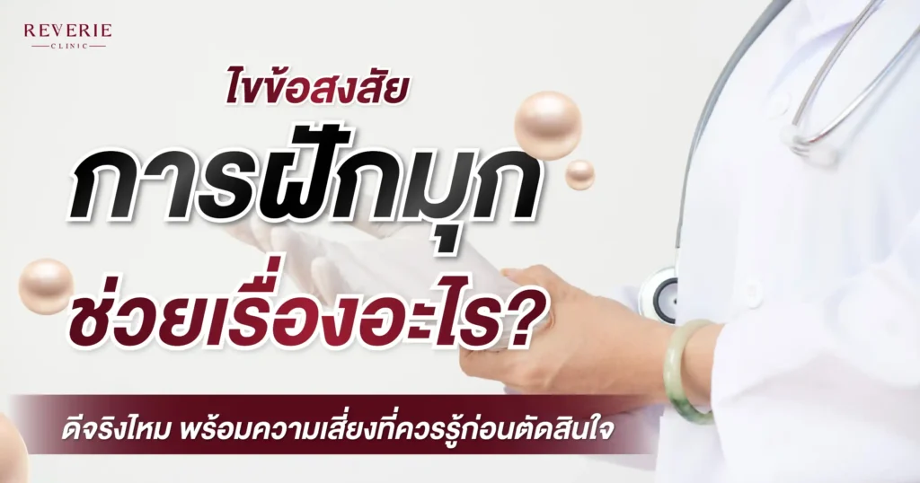 ไขข้อสงสัย ฝังมุกช่วยอะไร? ดีจริงไหม พร้อมความเสี่ยงที่ควรรู้ก่อนตัดสินใจ