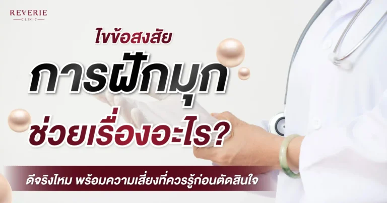 ไขข้อสงสัย ฝังมุกช่วยอะไร? ดีจริงไหม พร้อมความเสี่ยงที่ควรรู้ก่อนตัดสินใจ