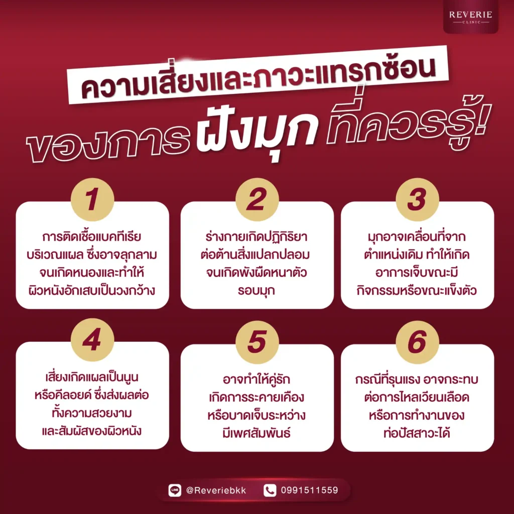 ความเสี่ยงและภาวะแทรกซ้อนของการฝังมุก