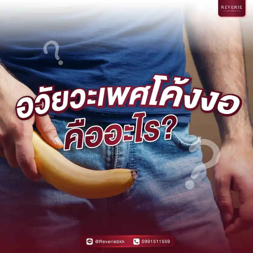 อวัยวะเพศโค้งงอ คืออะไร
