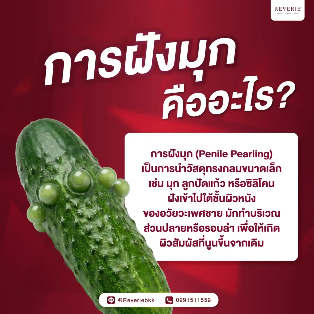 การฝังมุกคืออะไร