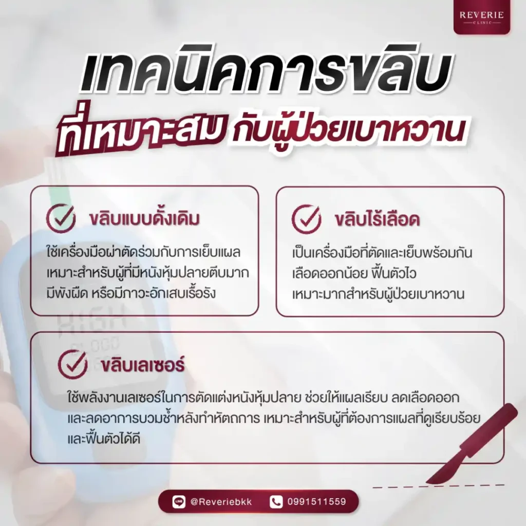 เทคนิคการขลิบที่เหมาะสมกับผู้ป่วยเบาหวาน