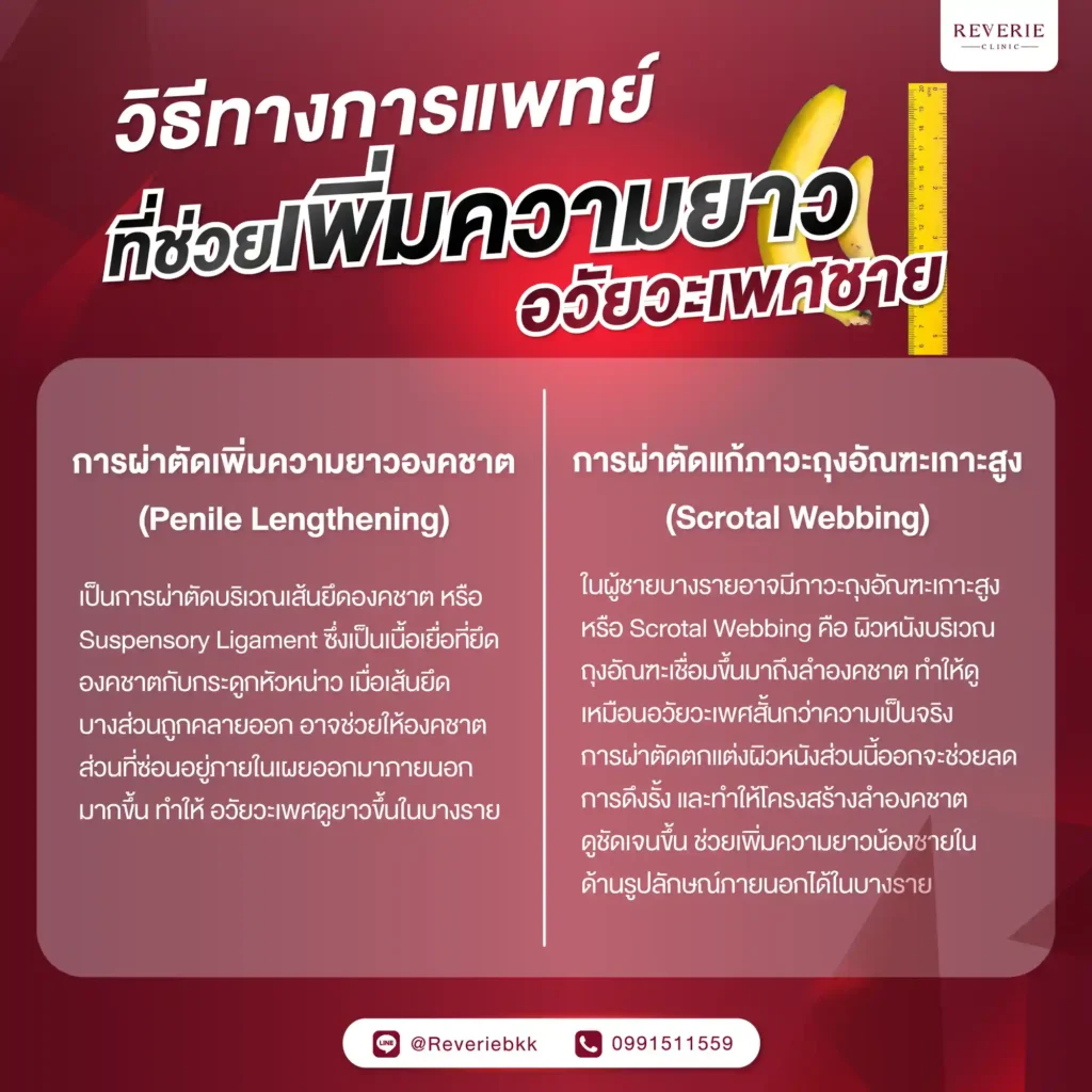 วิธีทางการแพทย์ที่ช่วยเพิ่มความยาวอวัยวะเพศชายในปัจจุบัน