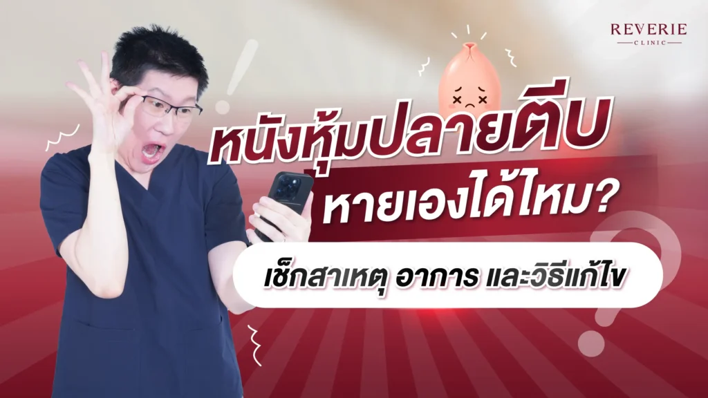 หนังหุ้มปลายตีบ หายเองได้ไหม? เช็กสาเหตุ อาการ และวิธีแก้ไข