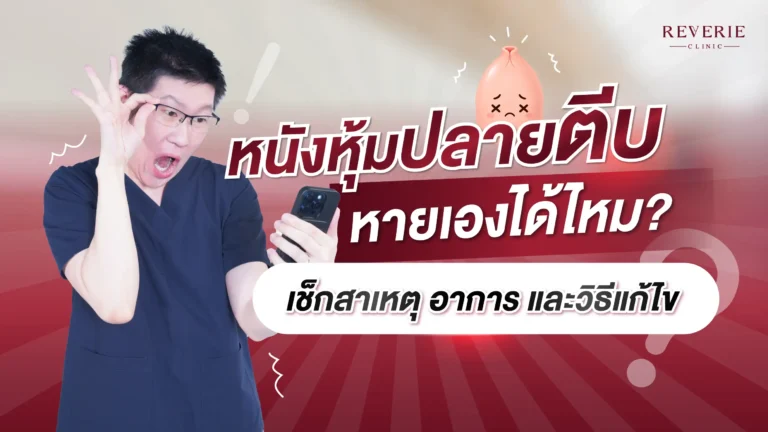 หนังหุ้มปลายตีบ หายเองได้ไหม? เช็กสาเหตุ อาการ และวิธีแก้ไข