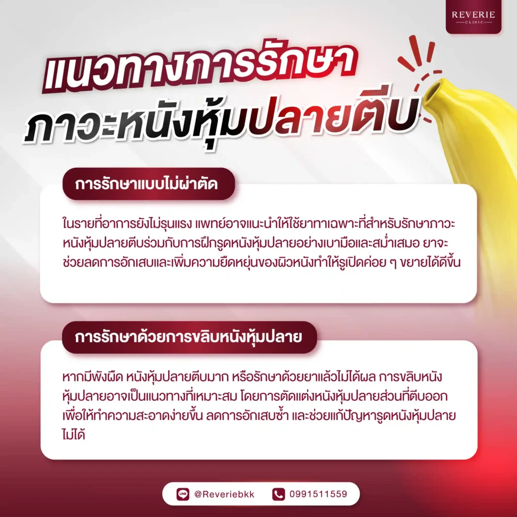 แนวทางการรักษาภาวะหนังหุ้มปลายตีบในปัจจุบัน