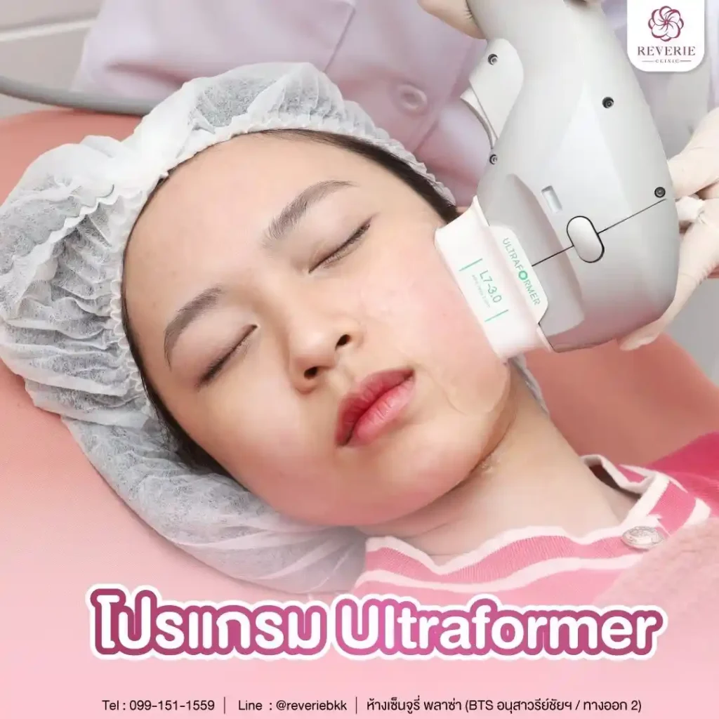 Ultraformer III 01