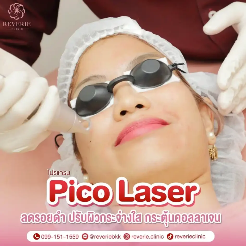 pico laser 01