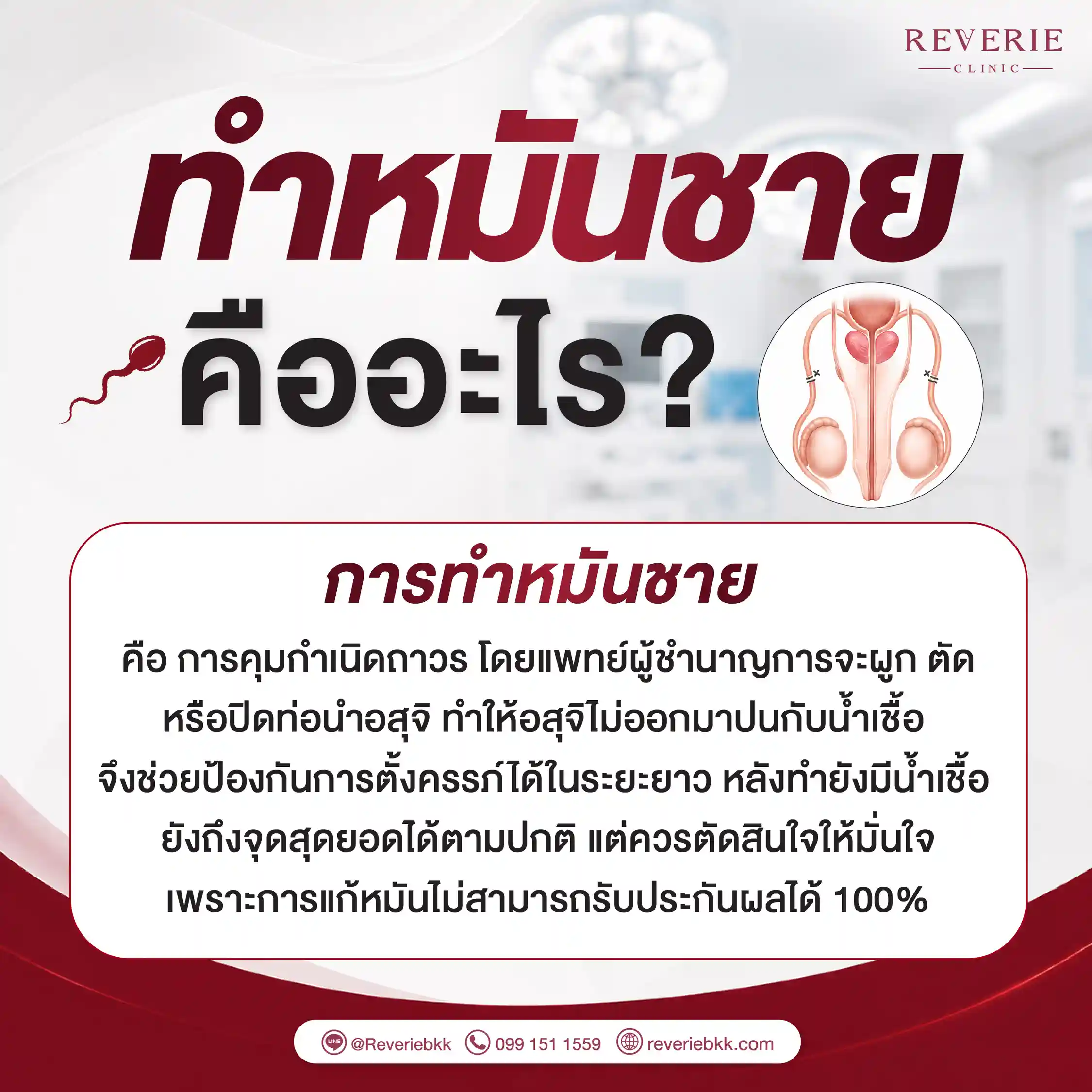 ทำหมันชายคืออะไร