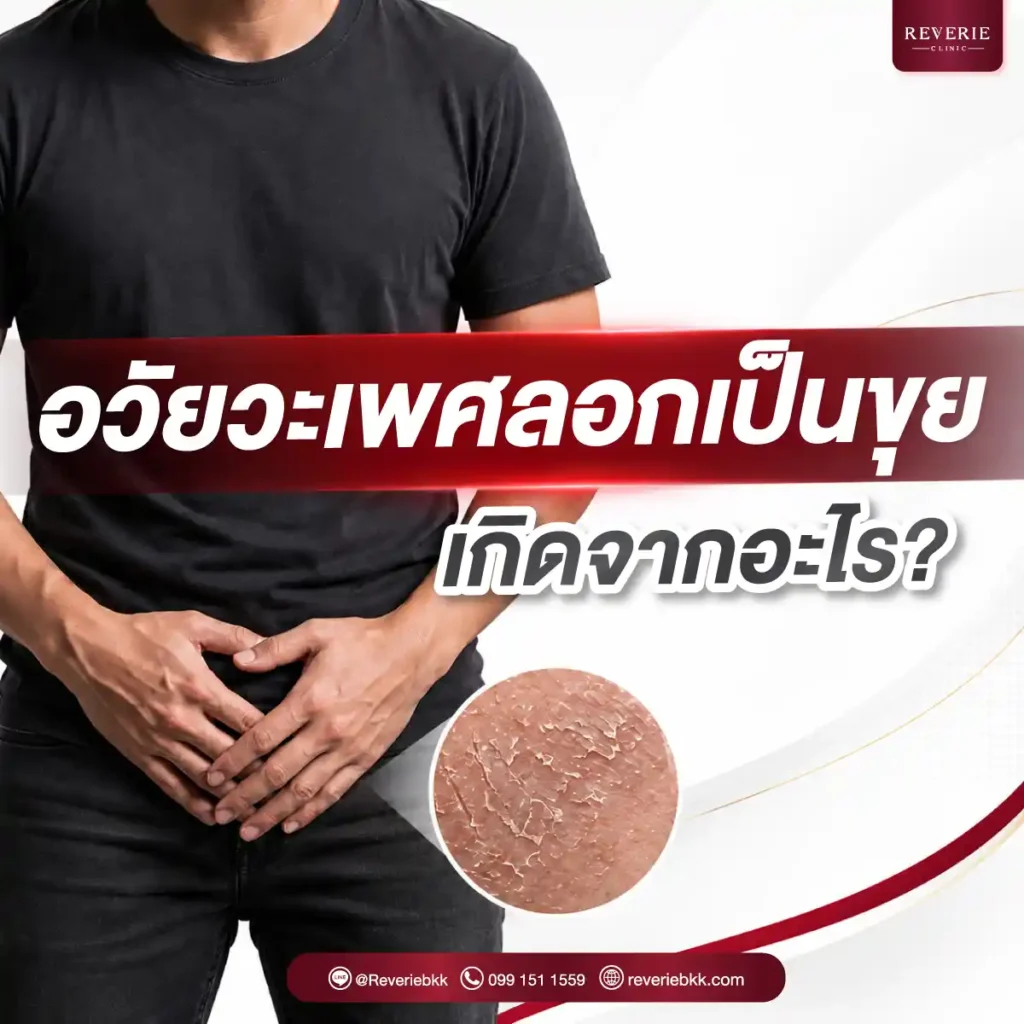 อวัยวะเพศลอกเป็นขุย เกิดจากอะไร