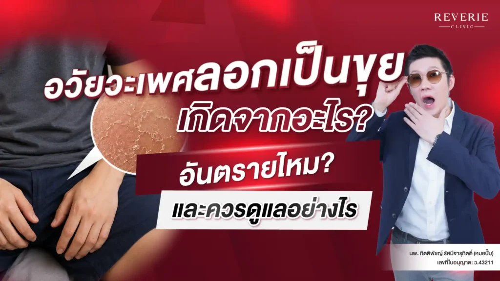 อวัยวะเพศลอกเป็นขุย เกิดจากอะไร? อันตรายไหม และควรดูแลอย่างไร