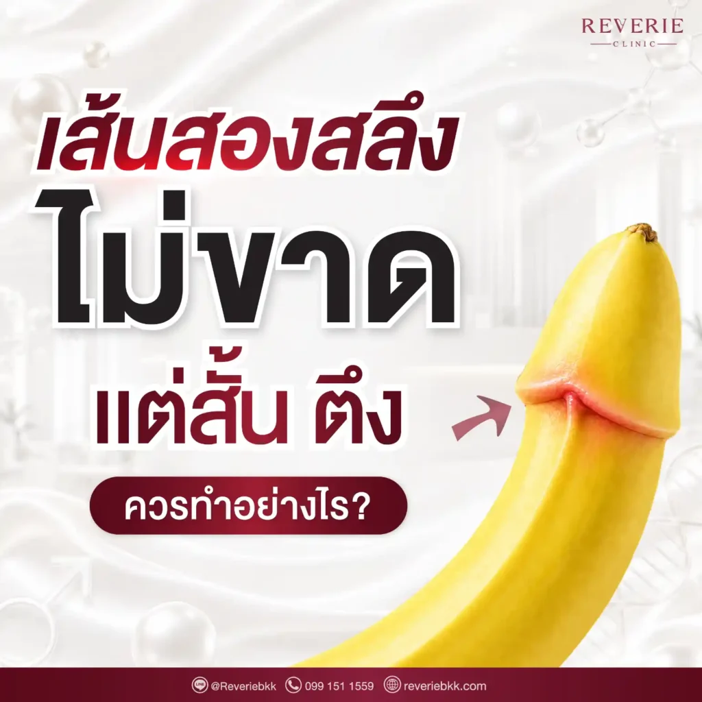 เส้นสองสลึงไม่ขาด แต่สั้น ตึง ควรทำอย่างไร