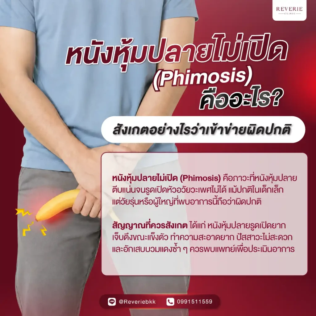หนังหุ้มปลายไม่เปิด (Phimosis) คืออะไร